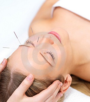 corteX acupuncture